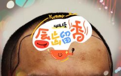 -大麦微针植发全国连锁