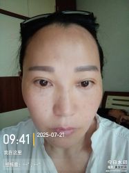 体验后-重庆军美医疗美容医院