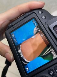 体验后-重庆军科整形美容医院