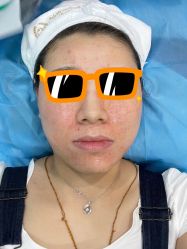 点击看大图 体验后-坤如玛丽·医疗美容中心