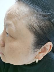 -长沙雅美医疗美容医院