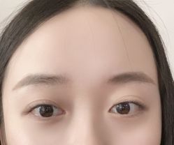 -宥莉·ULLY 痘敏肌•科技皮肤管理中心