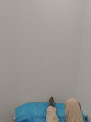 体验前-JUVA欧华医美连锁