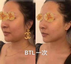 -LUNA皮相美·骨相美高级美感