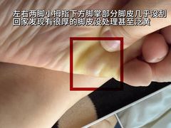 -郑远元专业修脚房(国顺东路店)