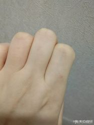 -晶奕空间专业脱毛连锁机构