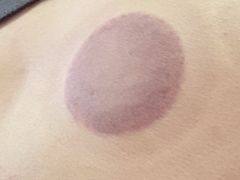 -沈师傅盲人按摩工作室(密三小区店)