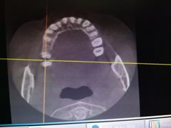 -成都市第一人民医院(南区)
