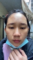 体验后-广州美莱医疗美容医院