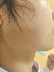 -长沙雅美医疗美容医院