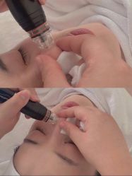 -美肤盾祛痘·问题肌头疗管理中心