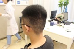 点击看大图 -大麦微针植发丨全国连锁