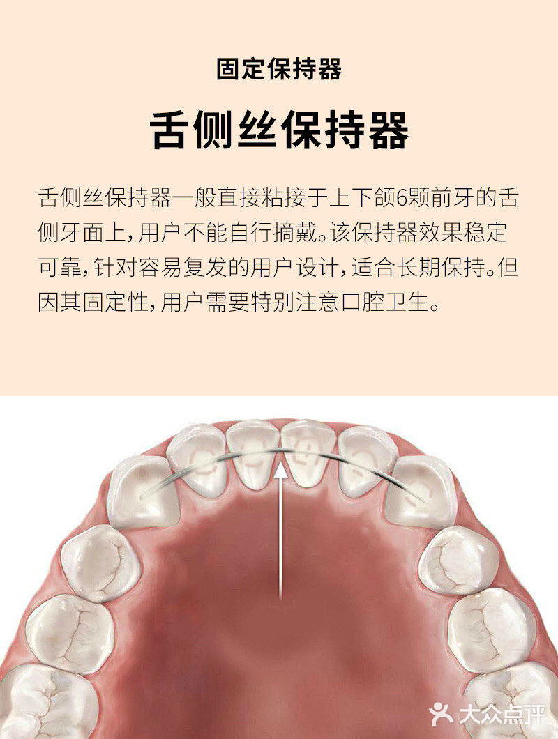 保持器到底要带多久才不会复发？