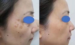 -Cream88颜皮肤管理中心