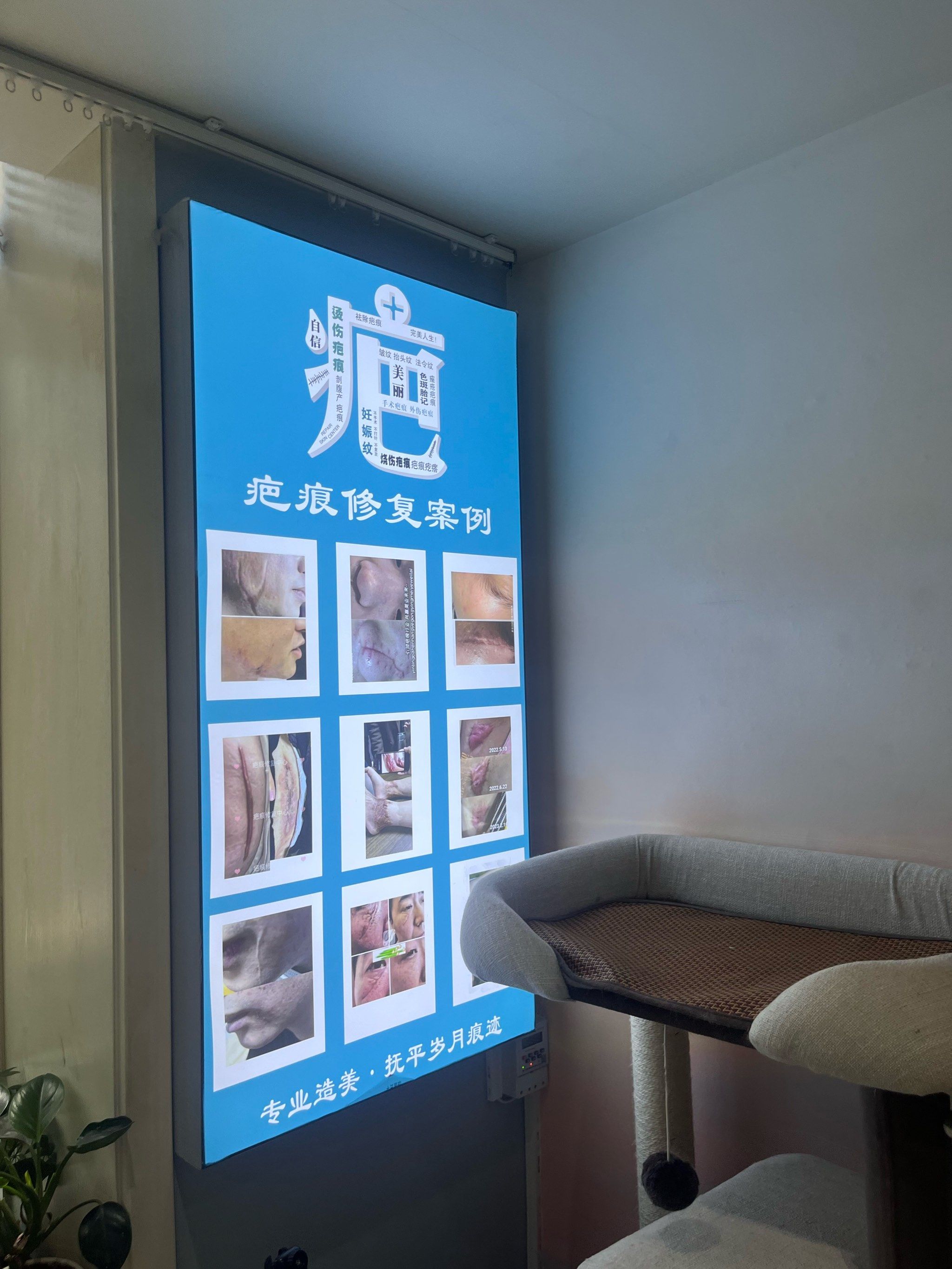 除疤技术不断进步 让伤痕不再困扰你
