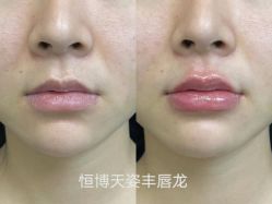 -恒博天姿医疗美容