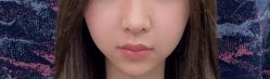 -长沙雅美医疗美容医院