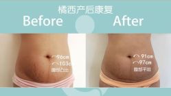 -橘西产后康复中心