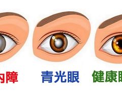 -标准眼镜·蔡司官方授权店(塘沽远洋未来汇店)
