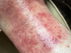 -大韩庄韩氏祖传正骨