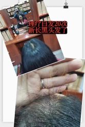 -顶尚堂白发脱发养发