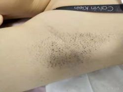 -薇兰专业脱毛连锁机构