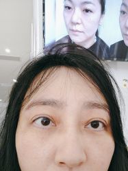 -广州健丽·去眼袋医疗美容机构