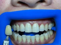 -极光口腔·矫正种植修复(锦江院区)