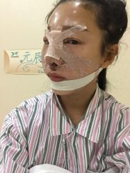 点击看大图 体验后-鑫元辰医疗美容整形