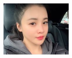 -大麦微针植发全国连锁