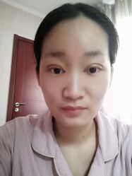 体验后-西安壹加壹医疗美容·西北抗衰旗舰店