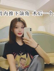 -大麦微针植发全国连锁