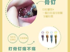 -极光口腔·矫正种植修复(锦江店)