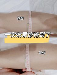 -Lily纤美·科技减脂中心