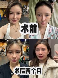 -上海时光整形外科医院
