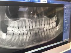 -Dr.Z dental仁康种植矫正中心