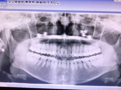 -上海市杨浦区牙病防治所