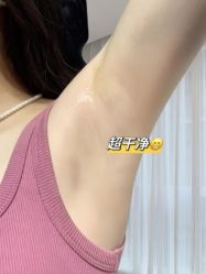 -薇兰专业脱毛连锁机构