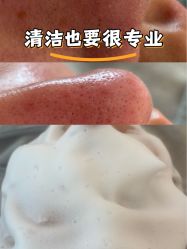 -skin79皮肤管理中心