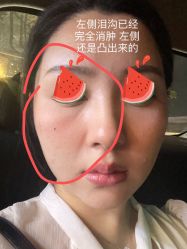 -美莱医疗美容医院
