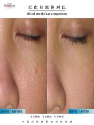 -黎蓓露·徒手骨雕蛋白抗衰·调肤管理