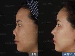 -北京米扬丽格医疗美容·联合丽格鼻整形中心