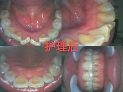 -深圳尔睦丽沙口腔门诊部(丽沙花都店)