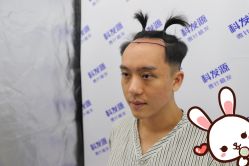 点击看大图 -大麦微针植发丨全国连锁