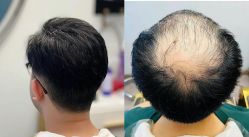-乐绅男士高端假发定制