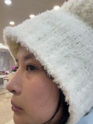 -长沙雅美医疗美容医院