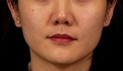 -Dr.U博士医疗美容医院