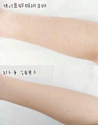 -薇兰专业脱毛连锁机构