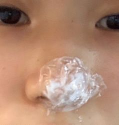 体验前-深圳美莱医疗美容医院