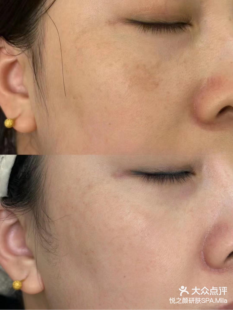 极光超皮秒效果新鲜出炉